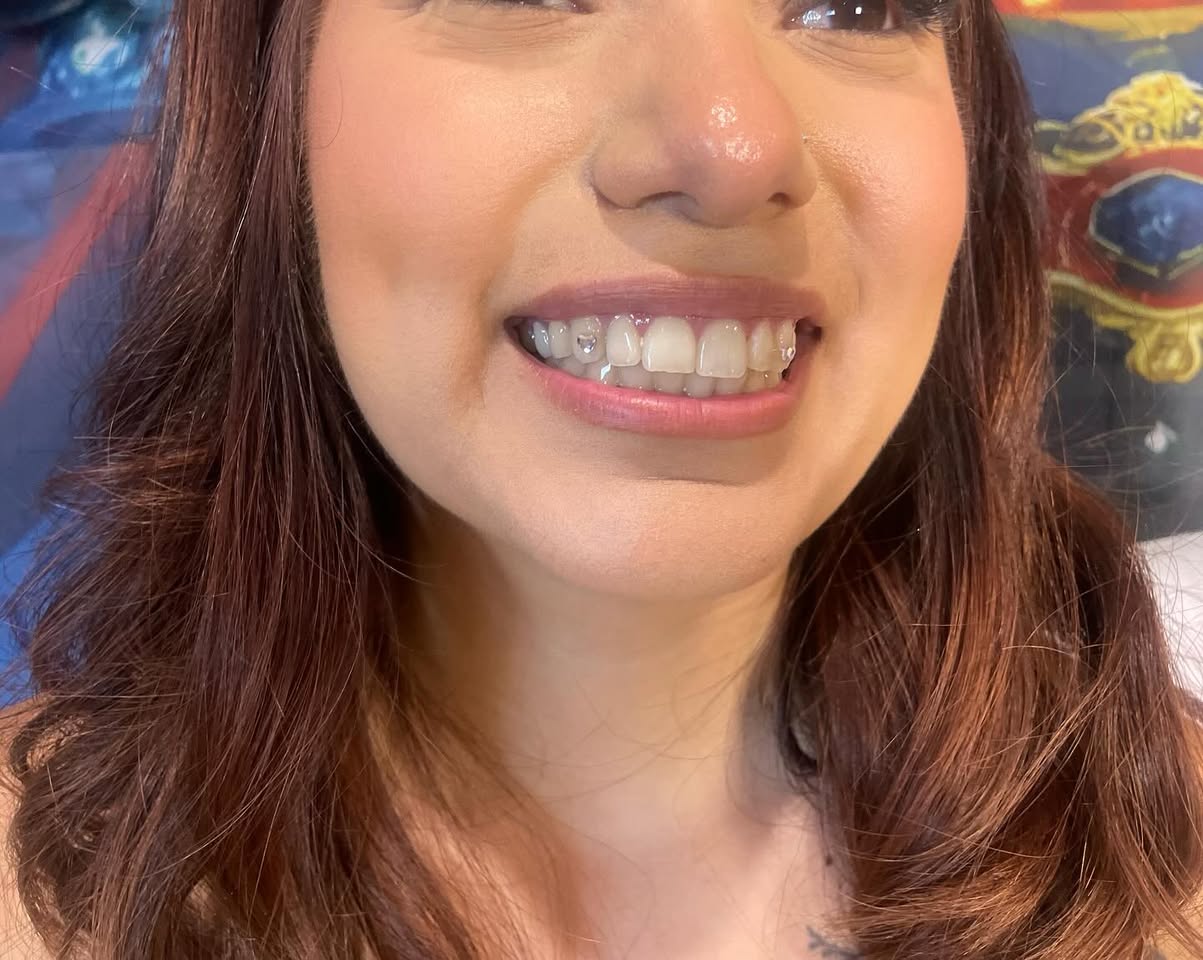 Single crystal tooth gem on a glossy smile by MakeupByGen